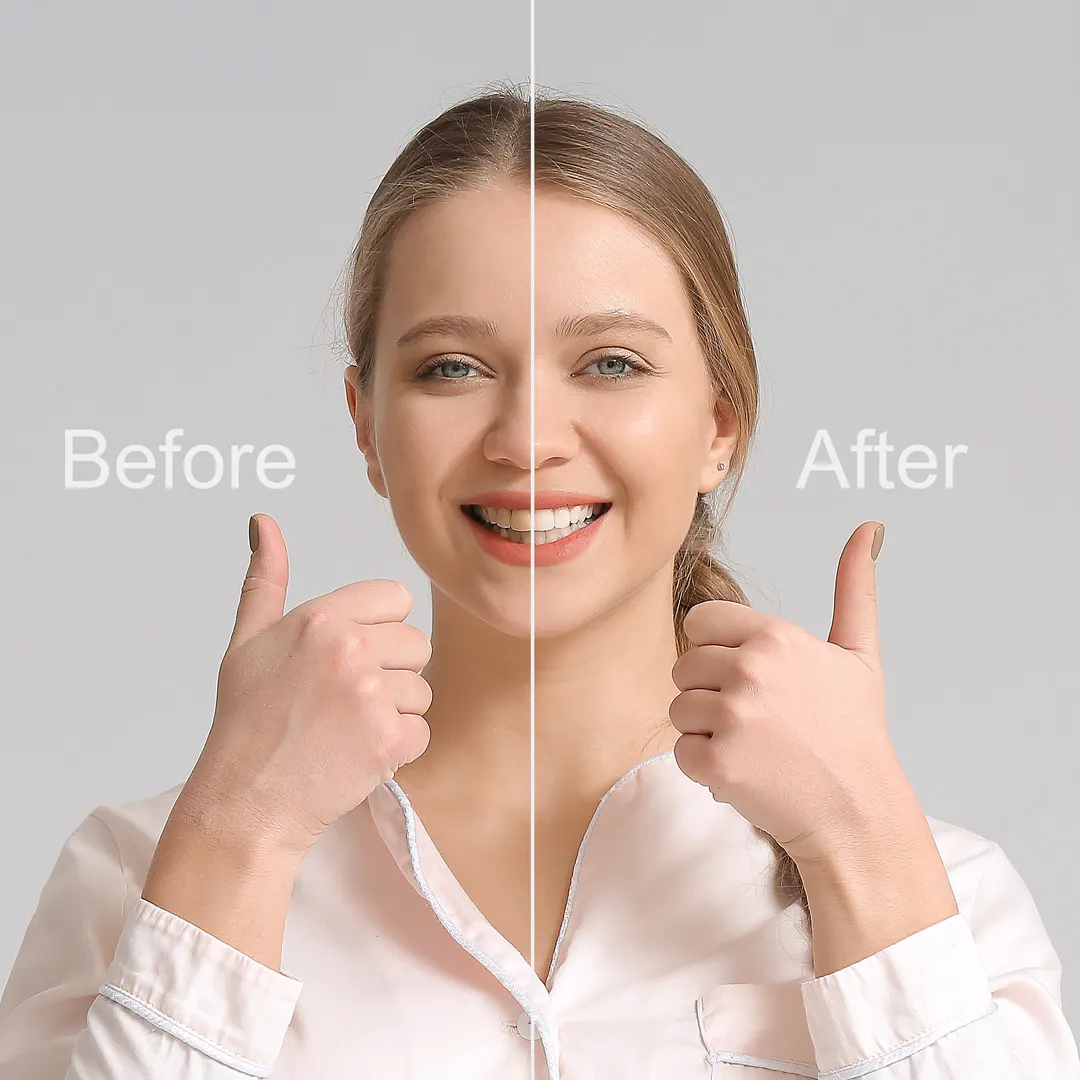 Smile Makeover