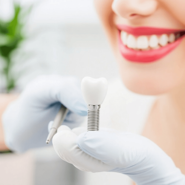 Caring for Your Dental Implants