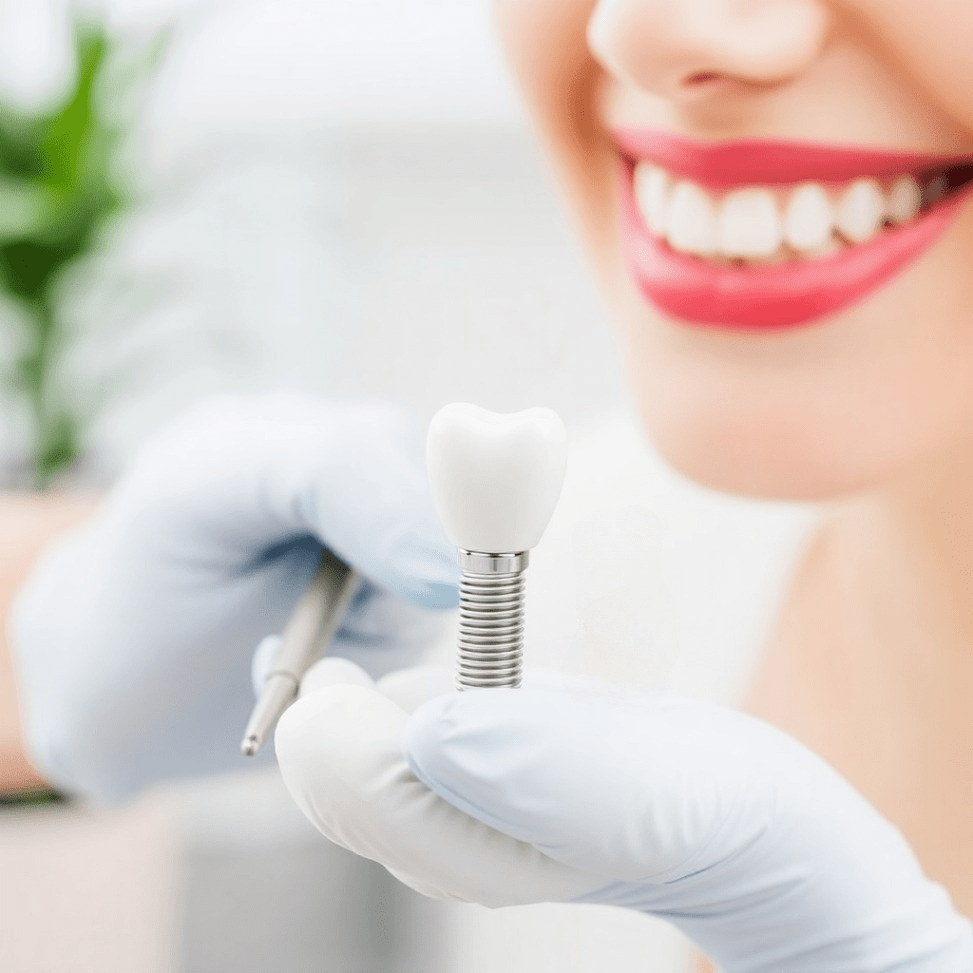 Caring for Your Dental Implants