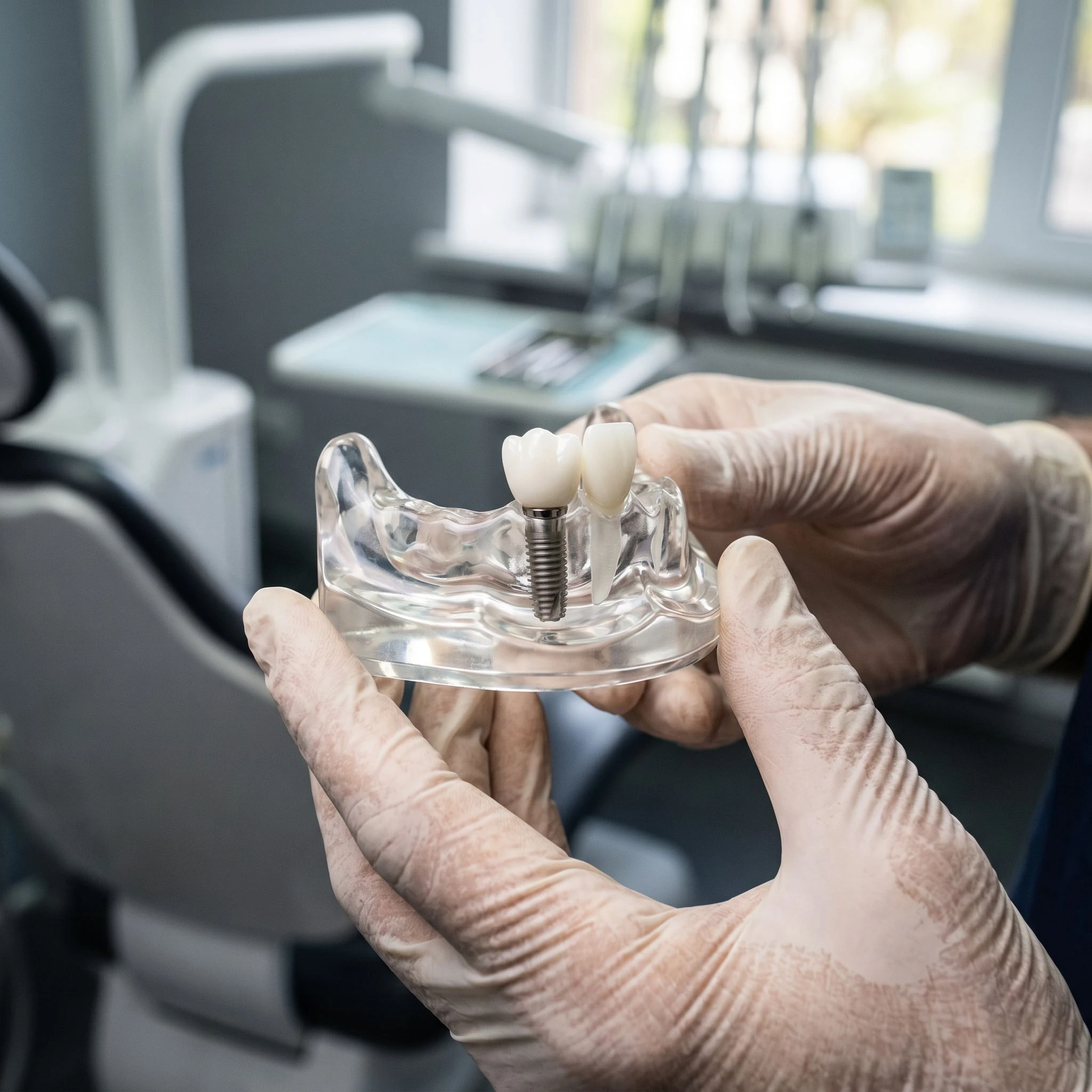 Is It Better to Save a Tooth or Replace It? Expert Insights - dental implants